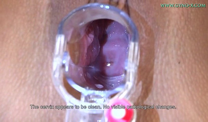 Naked blonde loves gyno examination in a doctor's office