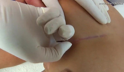 Gynecologist examines the juicy pussy of a beautiful brunette